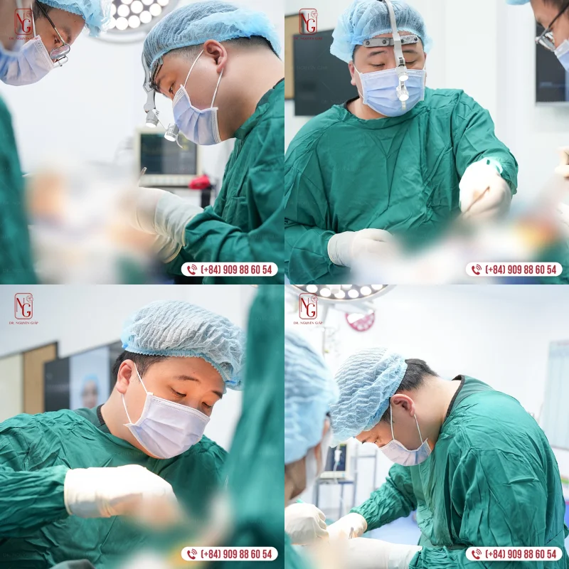 tham kham va soi da bang cong nghe fractional radio frequency