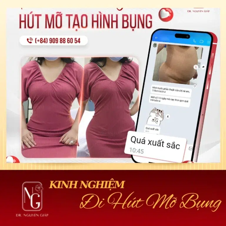 tim hieu ve phuong phap hut mo