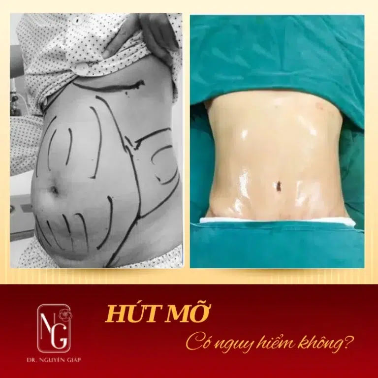 yeu to nao giup thuc hien join my hut mo thanh cong