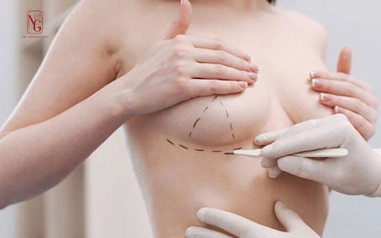 Những Điều Cần Biết Trước Khi Phẫu Thuật Nâng Ngực