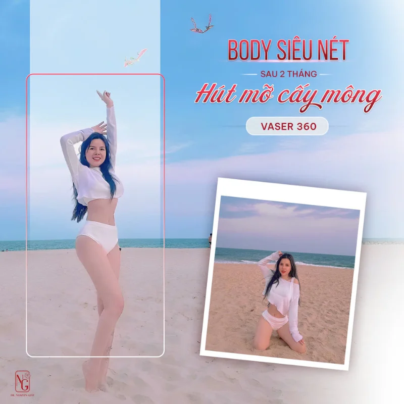 review khach hang after hut mo