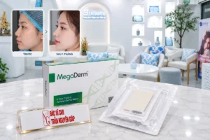 Hình ảnh thực tế sun megaderm 2 chính hãng được cấp phép sử dụng tại Thẩm mỹ Dr Nguyên Giáp