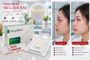 Hình ảnh thực tế sun megaderm 3 chính hãng được cấp phép sử dụng tại Thẩm mỹ Dr Nguyên Giáp