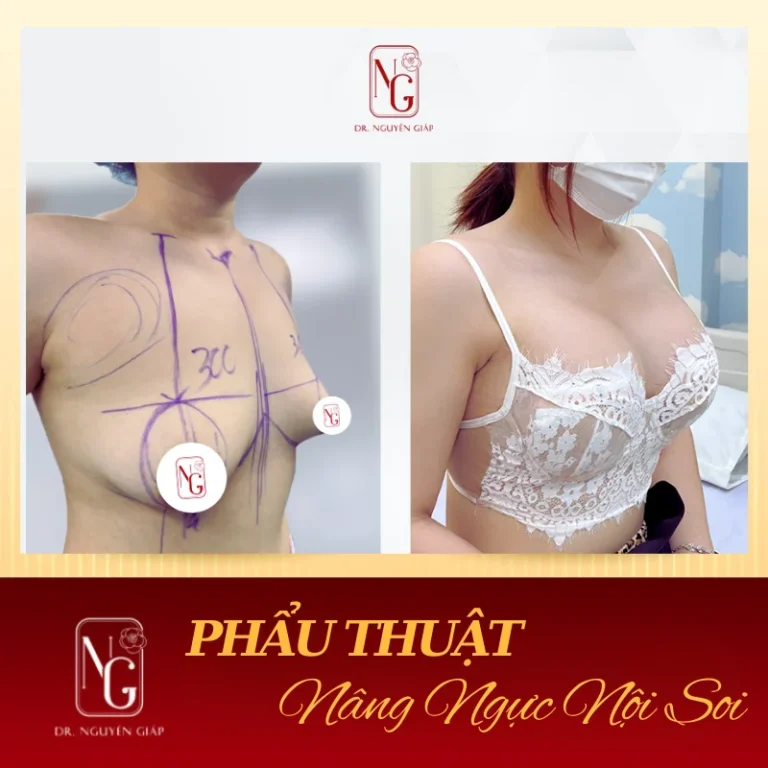 doi tuong phu hop voi nang, big noi soi