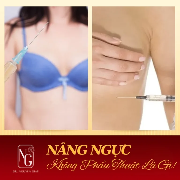 follicular big khong phau thuat