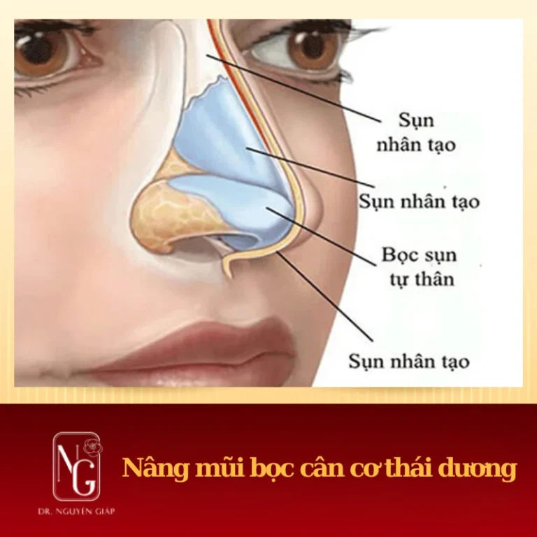 hinh anh nang mui bang sun