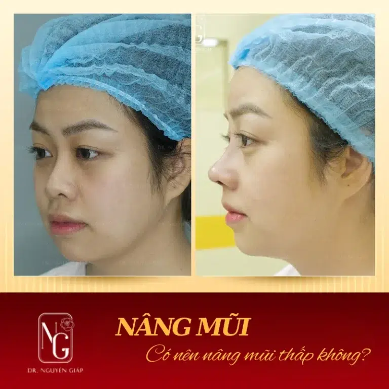 mui tet la gi anh huong cua mui tet den ngoai hinh va van so