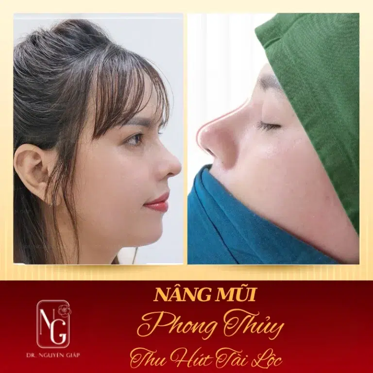 nang mui phong thuy tao dang mui dep hai hoa van menh