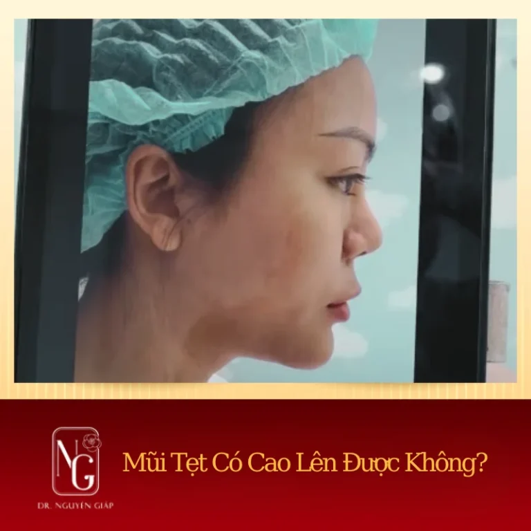 nguyen nhan gay ra mui tet