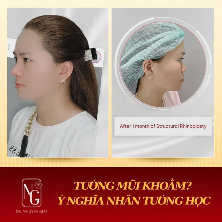 y nghia nhan tuong hoc cua dang mui khoam