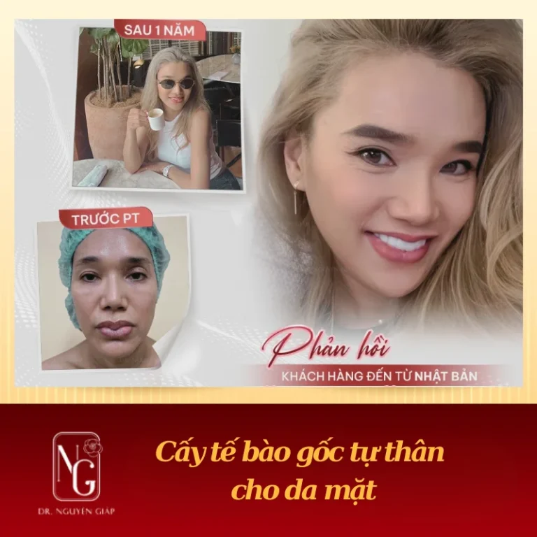 cang da mat bang cach spicy te bao goc