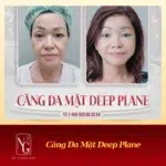 deep plane phu hop voi ai