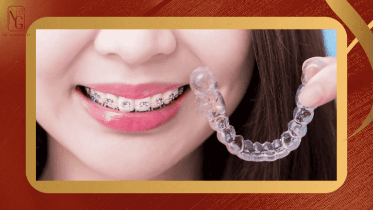 nen nang mui truoc hay nieng rang truoc