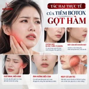 tac-two-cua-injection-botox-gon-ham Hình ảnh thực tế tac hai cua tiem botox gon ham chính hãng