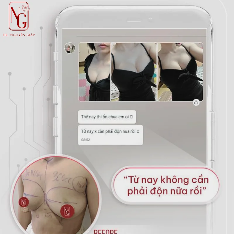 feedback tang vong 1 tu nhien ear dr nguyen giap