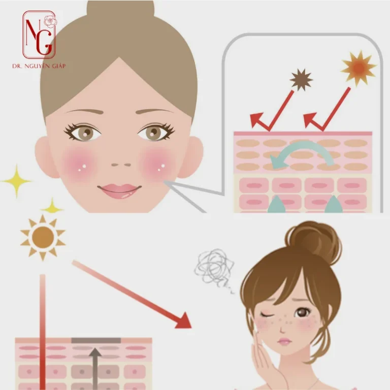 the best ever y nghia so pa in the cream chong nang