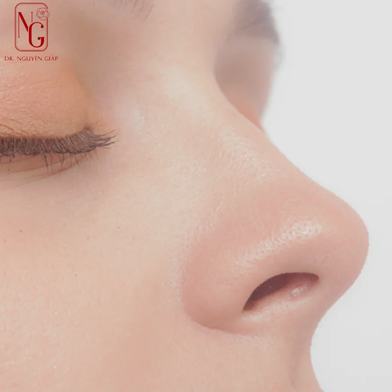 hinh anh sau khi dung tru mui thanh cong