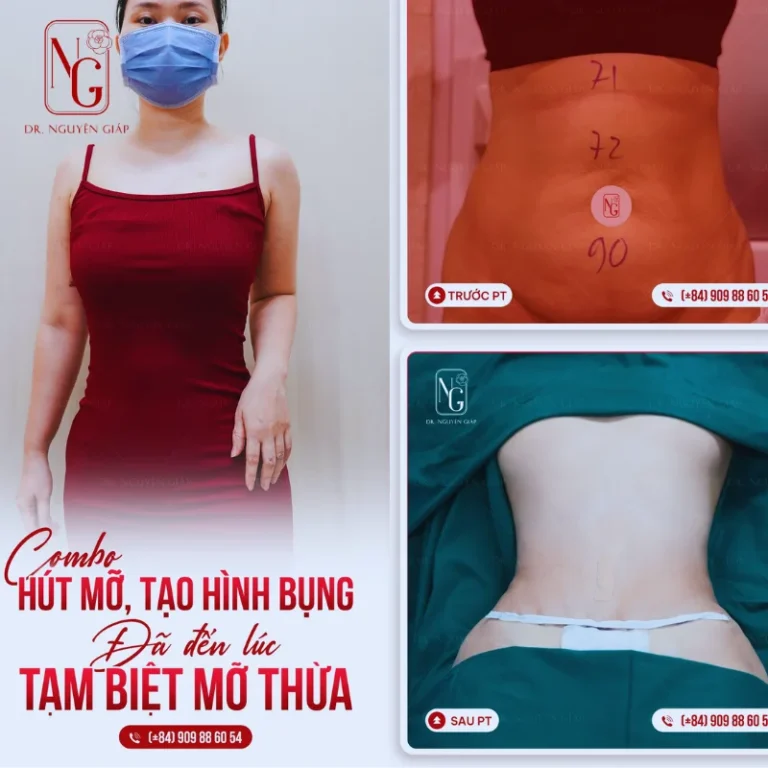 cham soc, anal, phau de confinement phu ne after hut mo