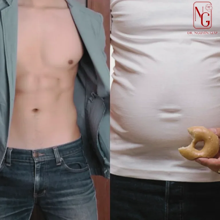 truoc va after hut mo bung I'm gay 6 mui