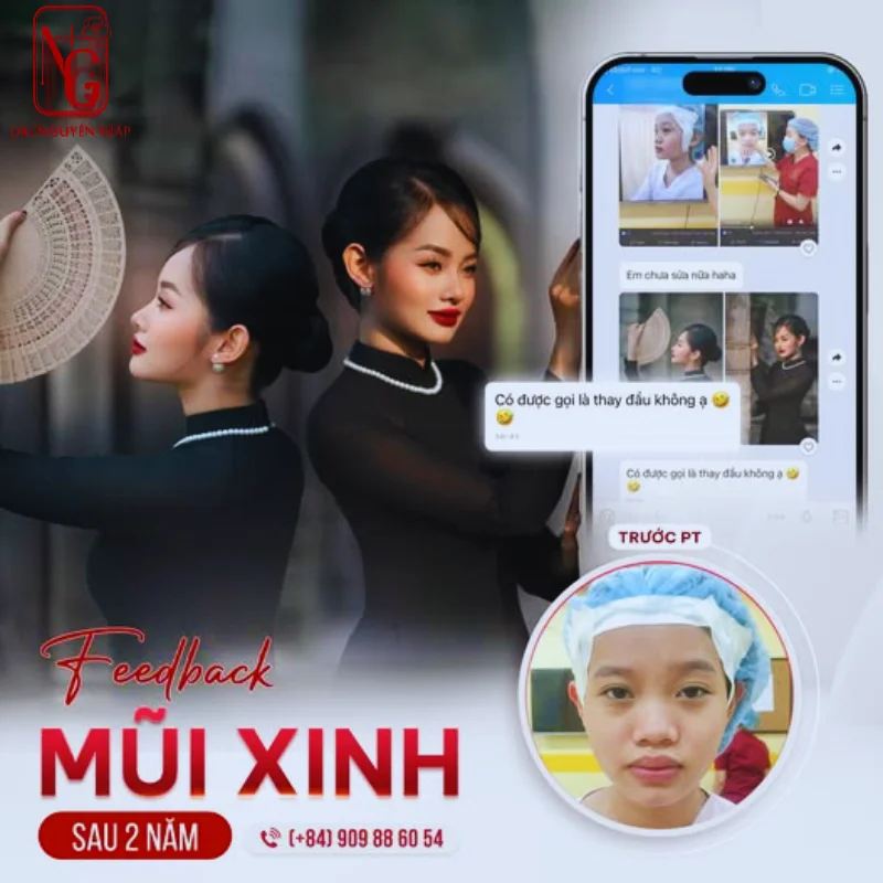 ky thuat cuon canh mui noi soi