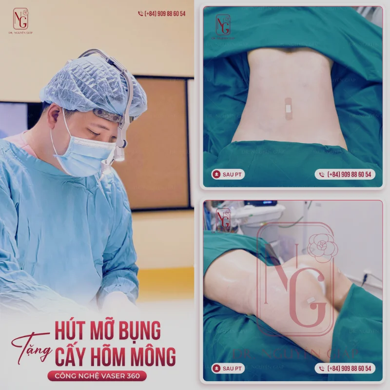 lieu trinh tri tham mong tai dr nguyen giap