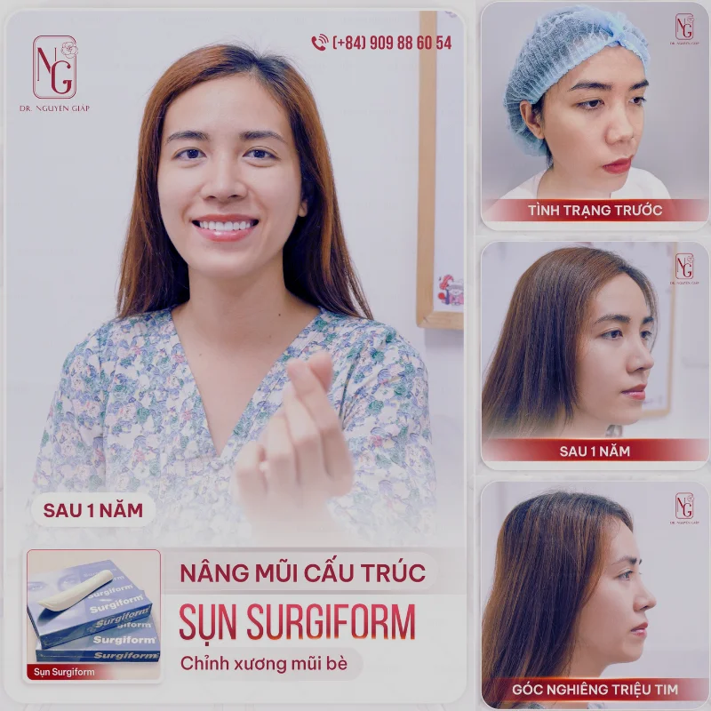 nang mui tai dr nguyen giap