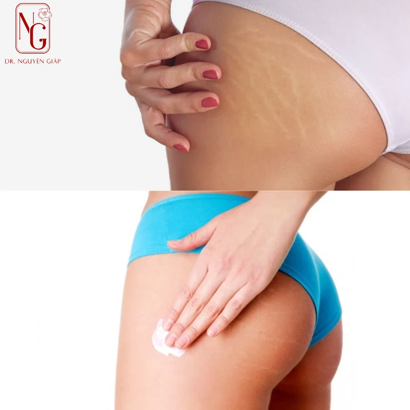 hand te bao chet giup giam take aim