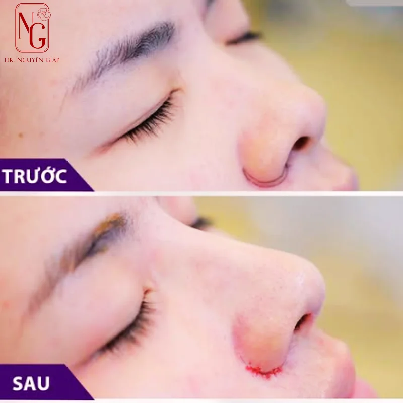 thu gon canh mui mang lai dang mui thon gon