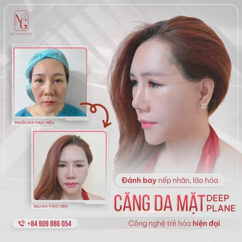 cong-nghe-cang-da-mat-tot-nhat cong nghe cang da mat tot nhat