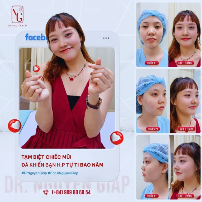 khach hang hai long sau nang mui