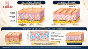 Sơ đồ cấu trúc y khoa mô phỏng cau truc collagen trong mo da thực hiện bởi Dr Nguyên Giáp