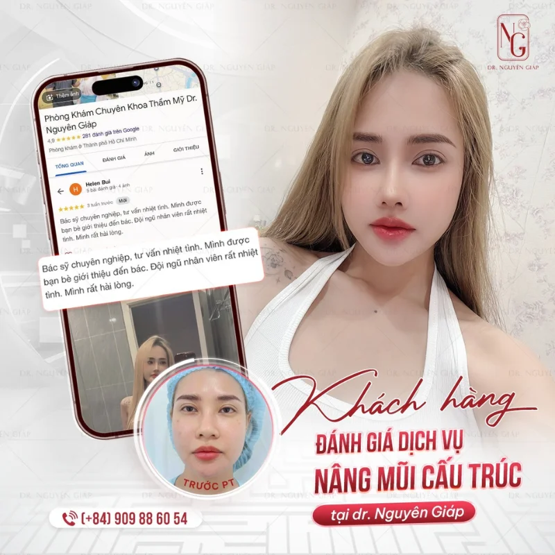 review nang mui cau truc