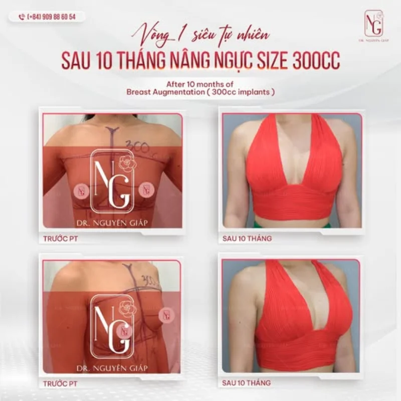 nang-nguc-285cc nang nguc 285cc