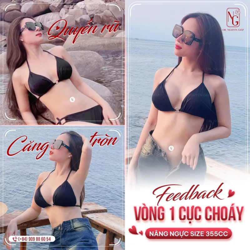 nang nguc co duoc vinh vien khong