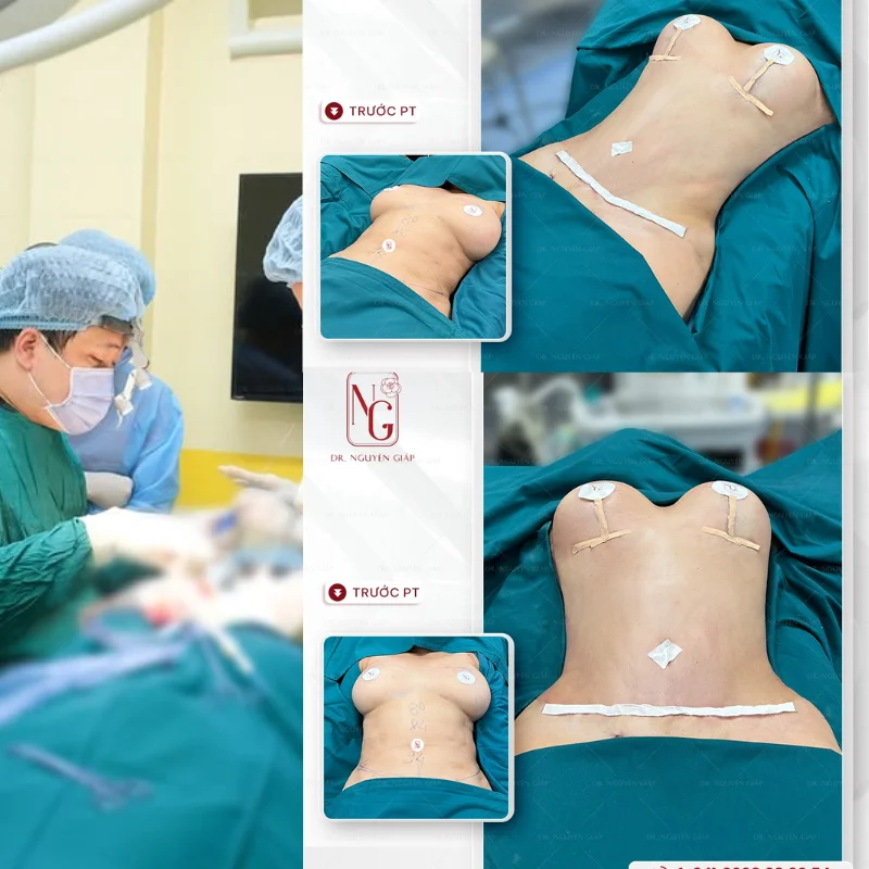 nang-nguc-size-285-co-dep-khong nang nguc size 285 co dep khong