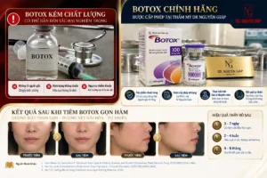 botox-kem-chat-luong-dan-den-tac-hai-nang-ne-sau-khi-tiem-botox-gon-ham-chinh-hang-dr-nguyen-giap Hình ảnh thực tế botox kem chat luong dan den tac hai nang ne sau khi tiem botox gon ham chính hãng được cấp phép sử dụng tại Thẩm mỹ Dr Nguyên Giáp
