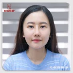 Kết quả sau khi cắt mí