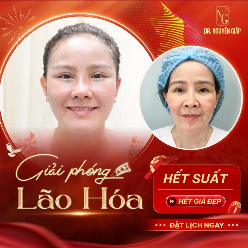 deals of the celebration of 30 months 4