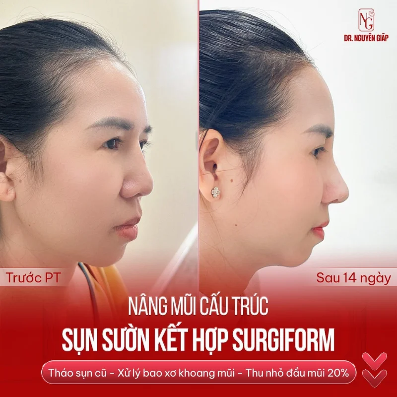 Sụn sinh học Surgiform