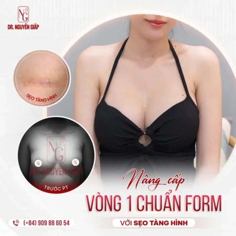 các kiểu ngực của phụ nữ phổ biến