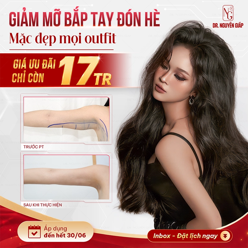 khuyến mãi hút mỡ bắp tay