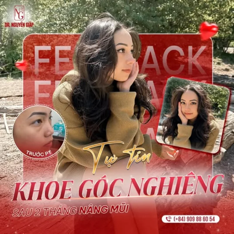 dáng mũi nào phù hợp cho tuổi dậy thì