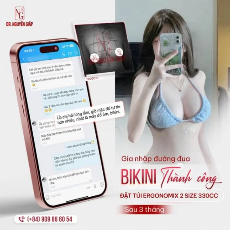 dáng ngực xinh đẹp sau khi nâng ngực