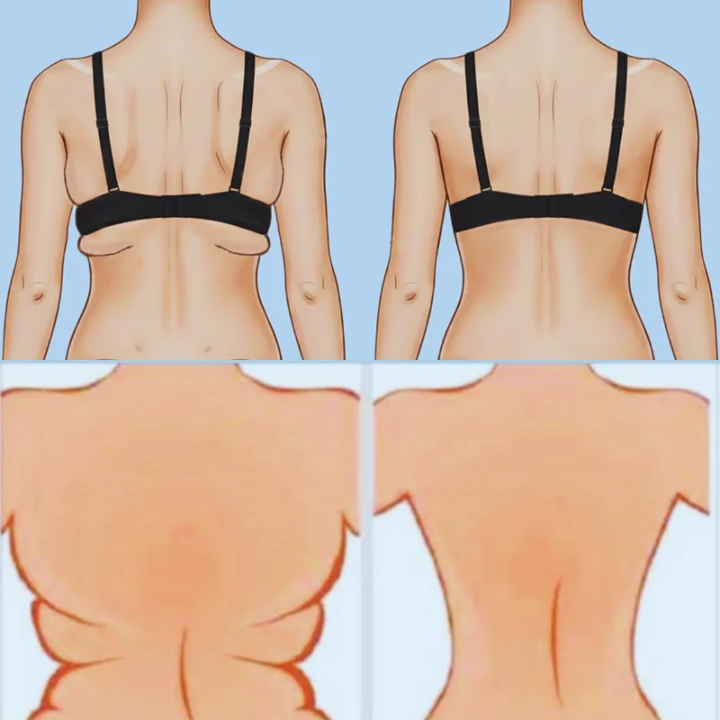 Causes Of Cardiovascular Backs