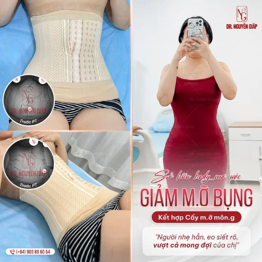 review liposuction of the abdomen of the customer