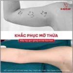 Bap tay to kem da chung kem san chac