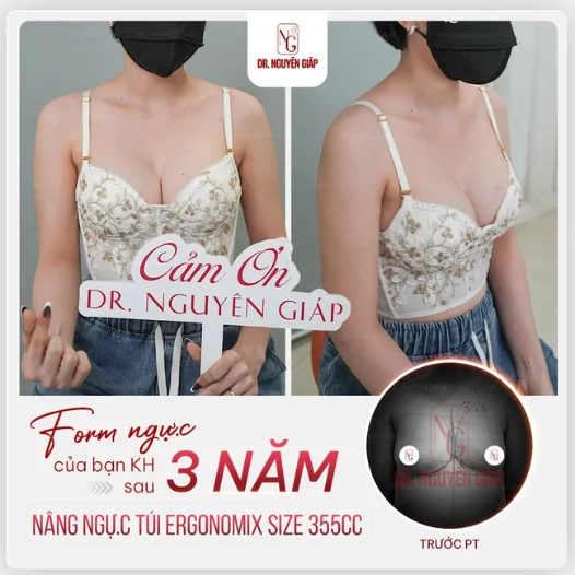 Review size chest pocket 315cc