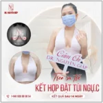 Túi ngực Ergonomix 2 là gì