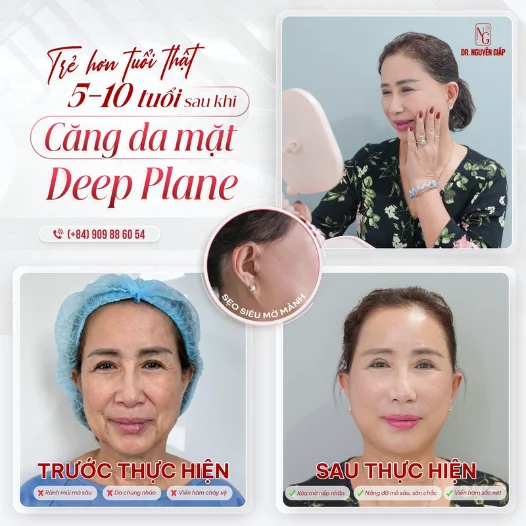 young as twenty-thanks to the method of deep plane