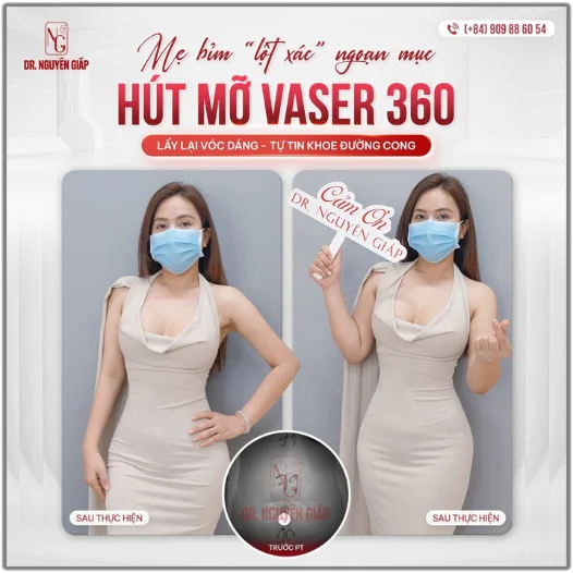 voc-dang-u50-trong-can-doi-hon-nho-cong-nghe-vaser-360 vóc dáng U50 trông cân đối hơn nhờ công nghệ vaser 360